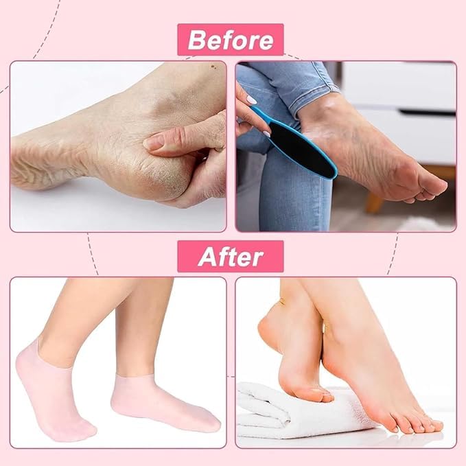 Silicone Moisturizing Gel Socks